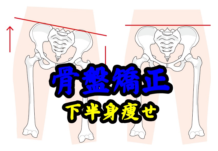 骨盤の矯正で下半身ダイエットが出来る?骨盤体操が太もも痩せに効果的!